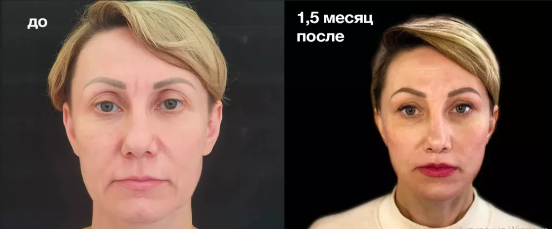 Фото с сайта клиники Доктора Гришкяна